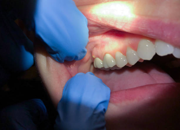 Best Emergency TMJ Treatment in Washington, WV