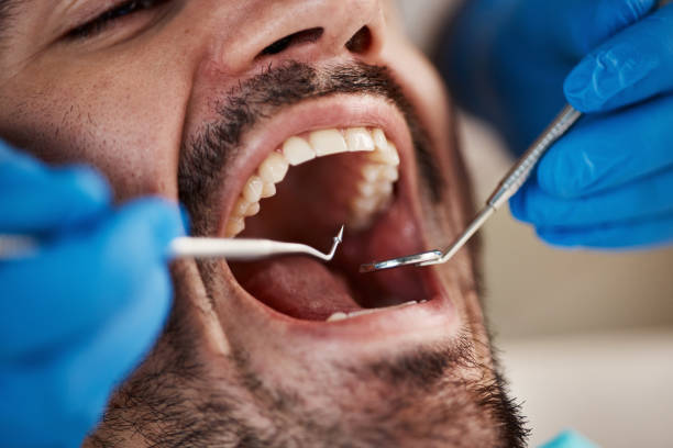 Best Emergency Treatment for Dental Infections or Abscesses in Washington, WV